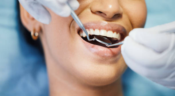 Best Broken or Chipped Tooth Repair in Daniels, WV