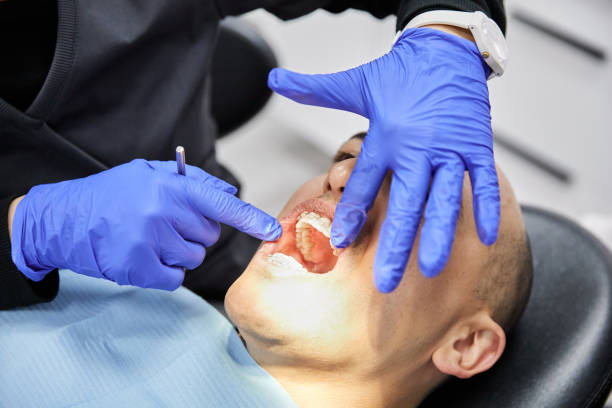 Best Emergency Wisdom Tooth Extraction in Daniels, WV