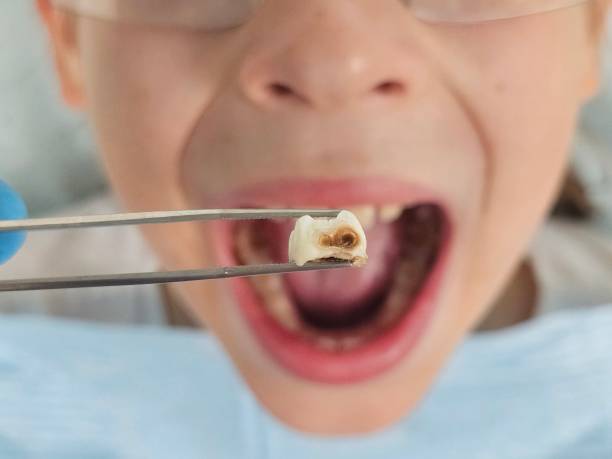 Best Emergency Dental Care for Sports Injuries in Daniels, WV