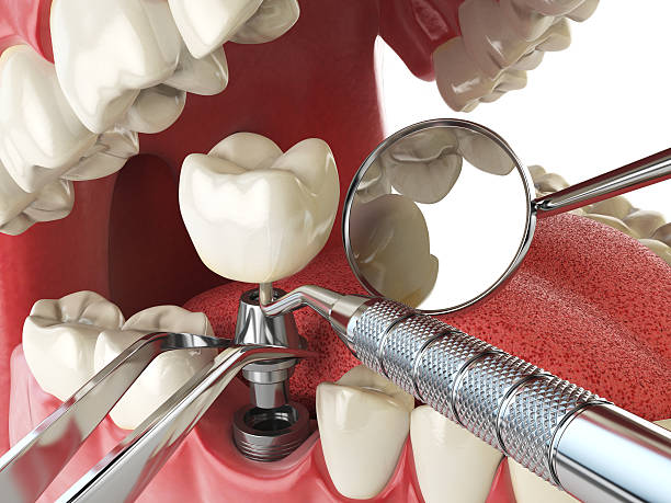 Best Emergency Denture Repair in Daniels, WV